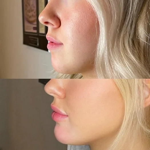 The Best Plastic Surgeon in dubai for Sculpted Chin Contours