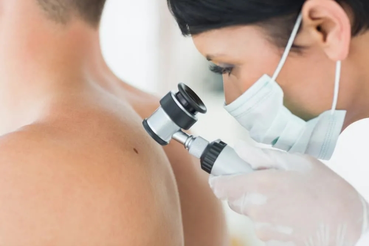 Stay Healthy with Bulk Bill Skin Cancer Clinics Near Me