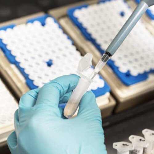 Isotopic Labels: Understanding Carbon-13, Oxygen-18, Deuterium, and Nitrogen-15